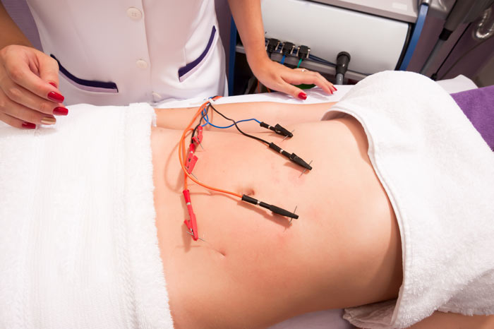 Láser lipo, electrolipólisis