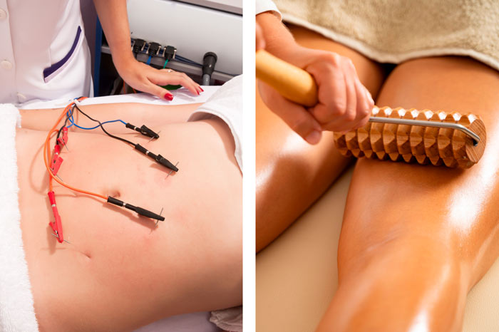 Láser lipo, electrolipólisis